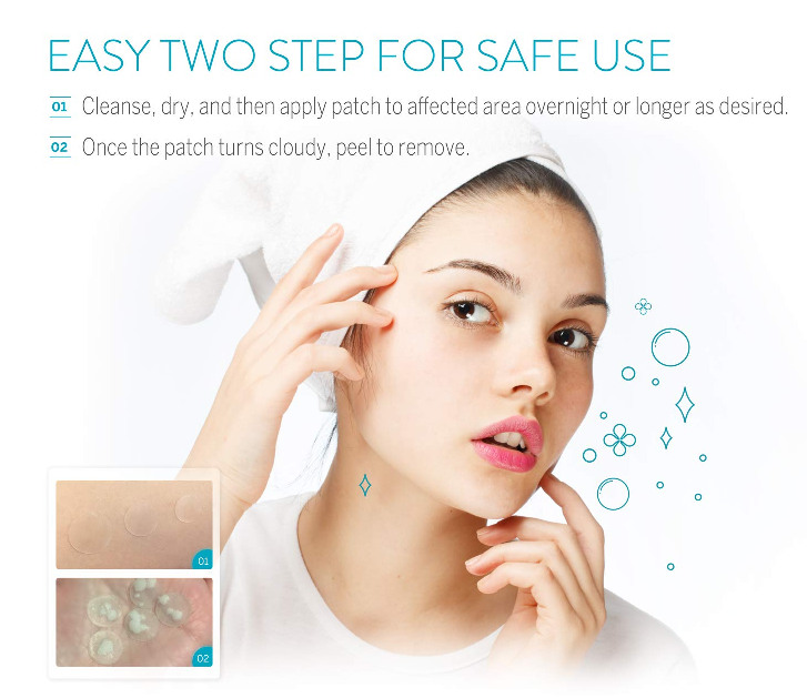 Remedy for acne - acne patches