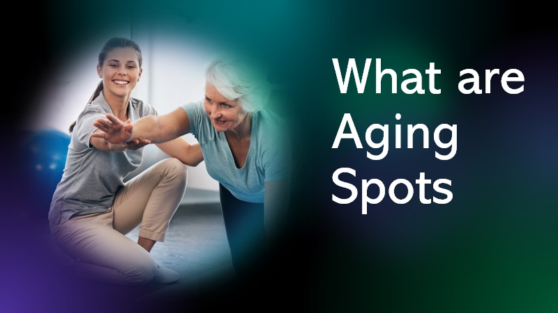 aging spots