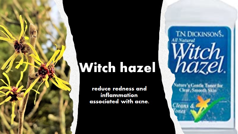 acne-prone skin - witch hazel